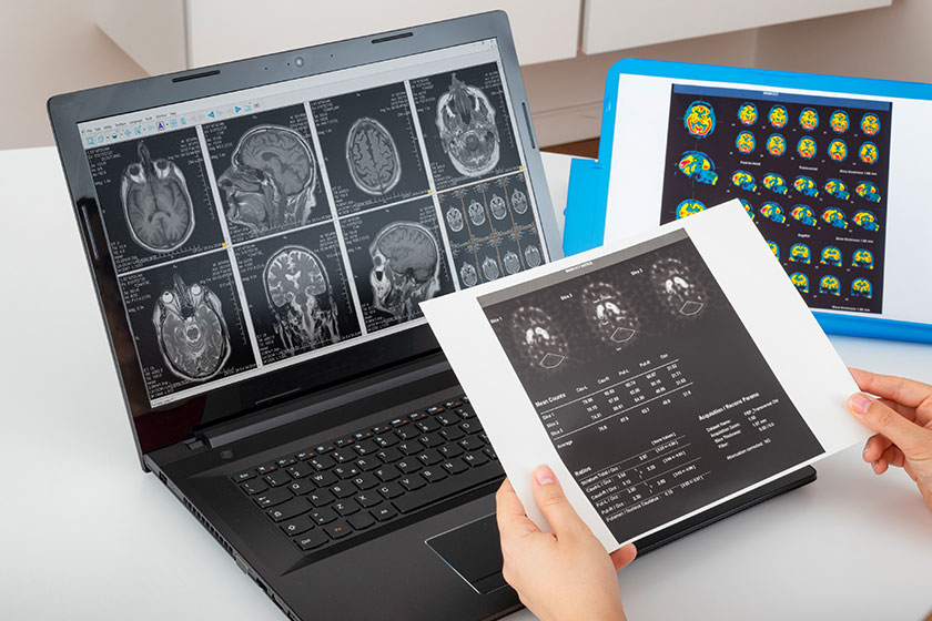 How To Tell If A Loved One Needs Alzheimer’s Disease Screening How To Tell If A Loved One Needs Alzheimer's Disease Screening