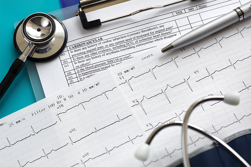 Cardiogram and stethoscope Cardiogram and stethoscope