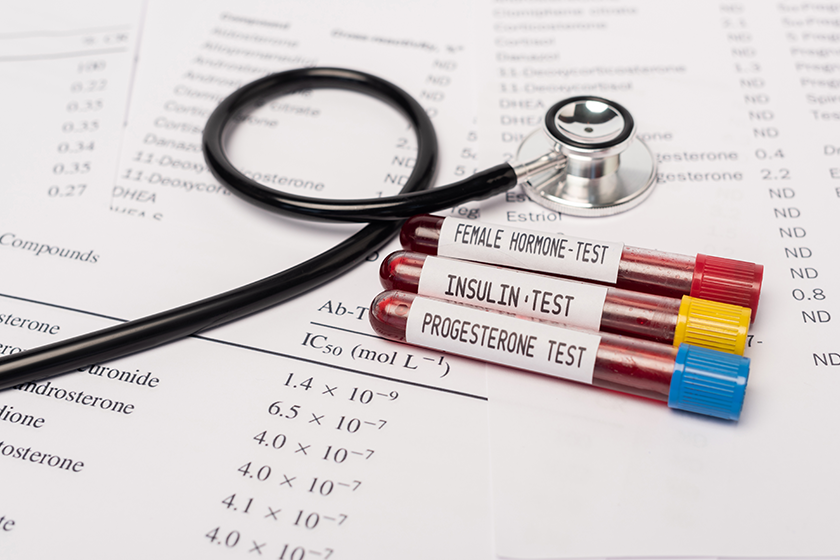 close view test tubes close view test tubes