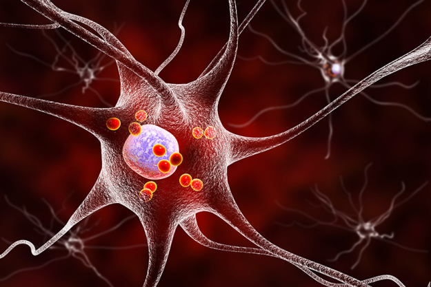 neurons in parkinsons disease